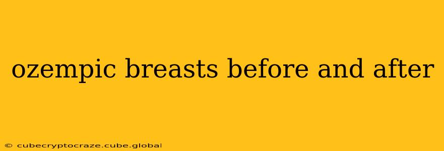 ozempic breasts before and after