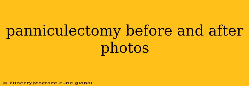 panniculectomy before and after photos