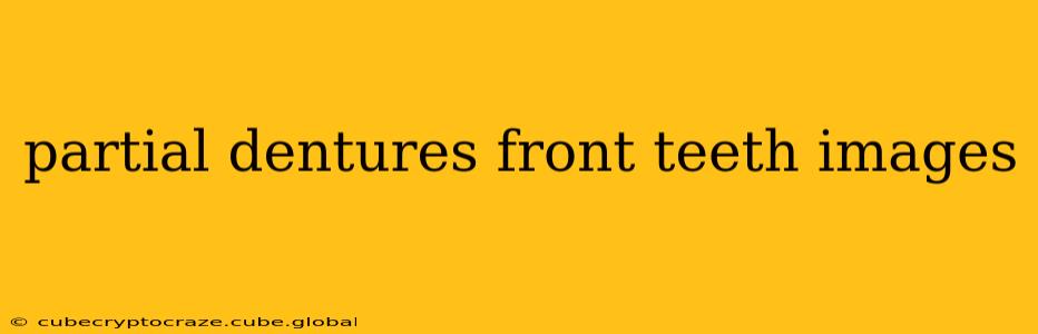 partial dentures front teeth images
