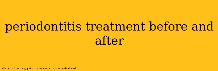 periodontitis treatment before and after
