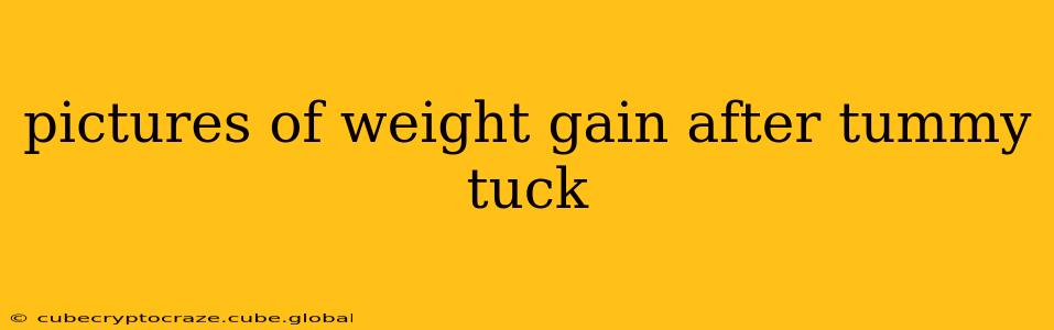 pictures of weight gain after tummy tuck