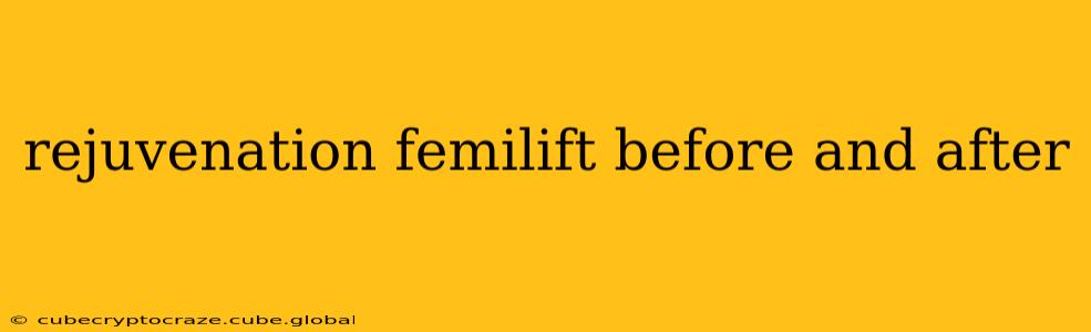 rejuvenation femilift before and after