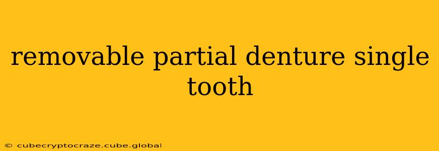 removable partial denture single tooth