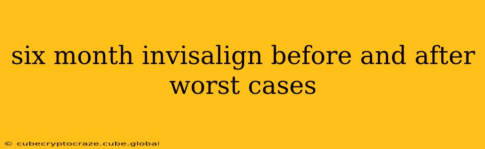 six month invisalign before and after worst cases