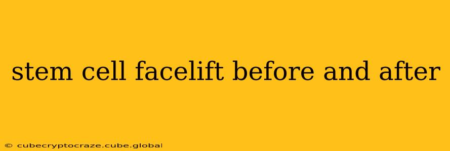 stem cell facelift before and after