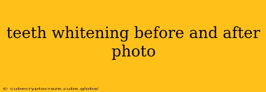 teeth whitening before and after photo