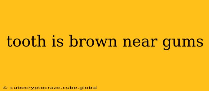 tooth is brown near gums