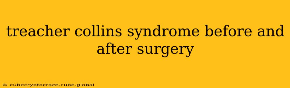 treacher collins syndrome before and after surgery