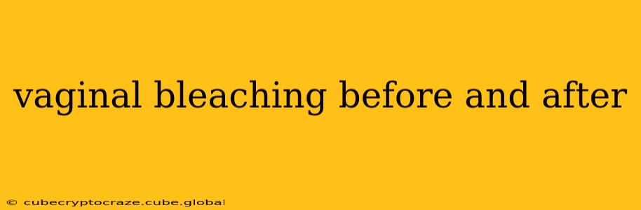 vaginal bleaching before and after