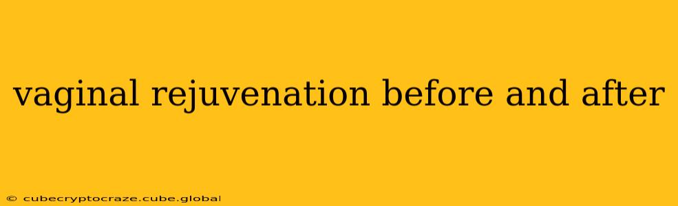 vaginal rejuvenation before and after