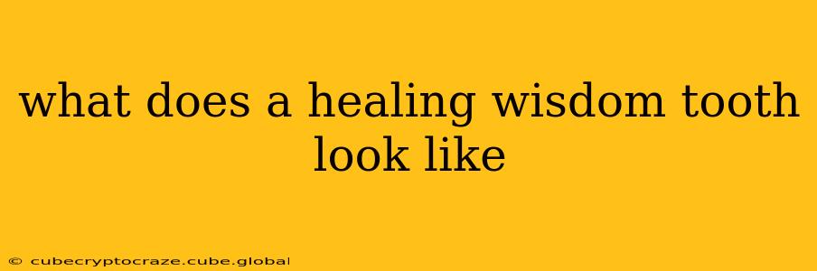 what does a healing wisdom tooth look like
