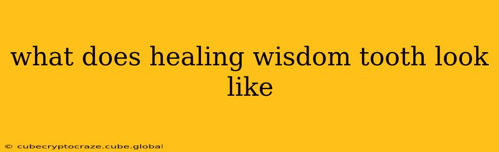 what does healing wisdom tooth look like