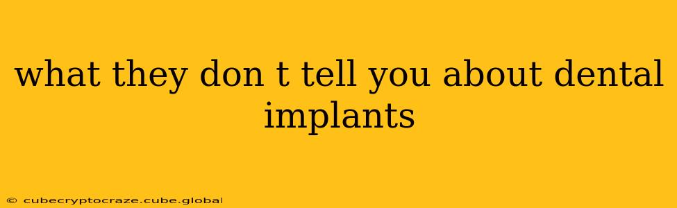 what they don t tell you about dental implants