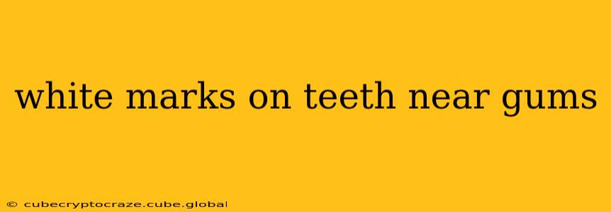 white marks on teeth near gums