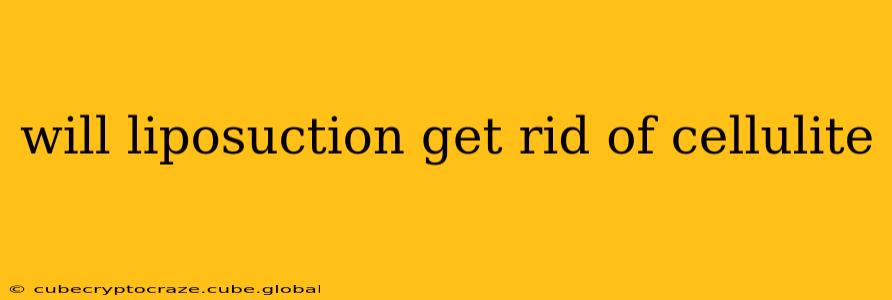 will liposuction get rid of cellulite